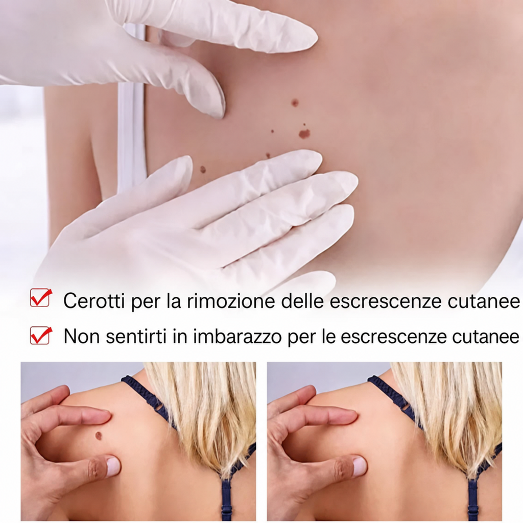 Penna naturale per la rimozione di fibromi cutanei e nei