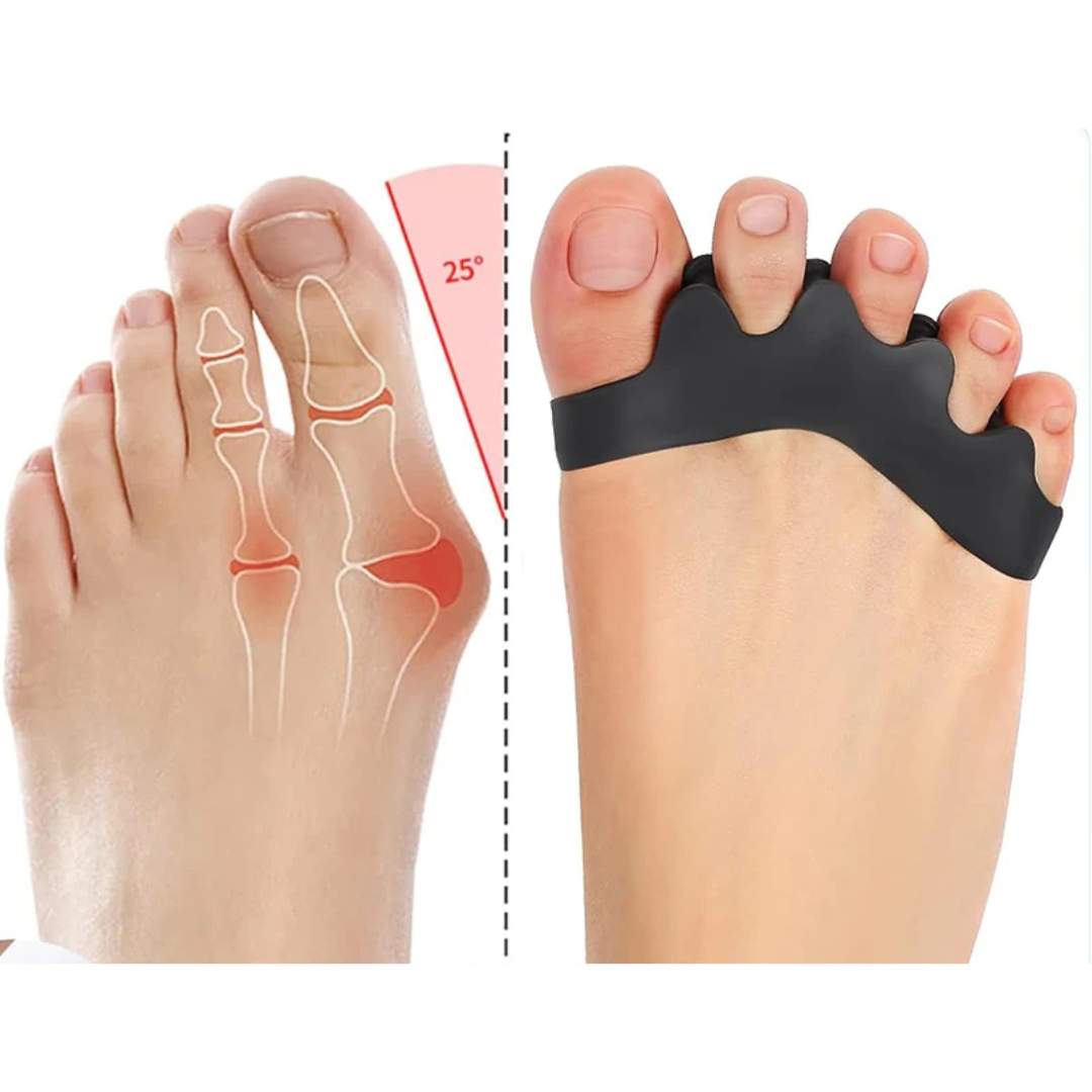 FlexAlign Toe Spacer | Distanziatore per dita dei piedi per riallineamento e sollievo dal dolore – Ideale per alluce val